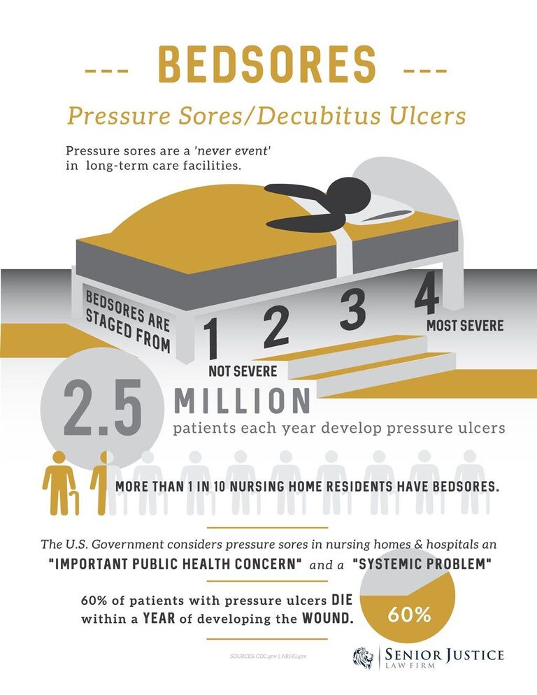 Bed sore Lawsuit Facts and Infographic.