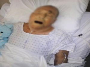 Septic shock in hospital patient leads to wrongful death lawsuit